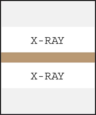 Medical Arts Press Standard Preprinted Chart Divider Tabs; X Ray Tan
