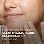 Neutrogena Oil-Free Acne Wash Pink Grapefruit Foaming Scrub, 6.7 Fl. Oz (06447)~#|#~099F4F92-CC26-47F4-8A0998D667B19892_sc7