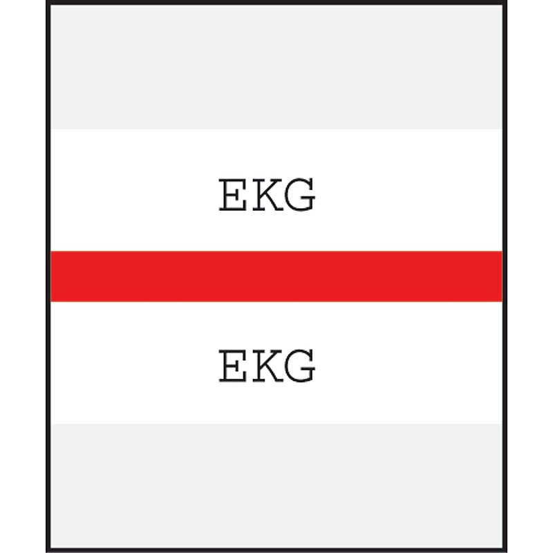 Medical Arts Press® Standard Preprinted Chart Divider Tabs; EKG, Red image 1