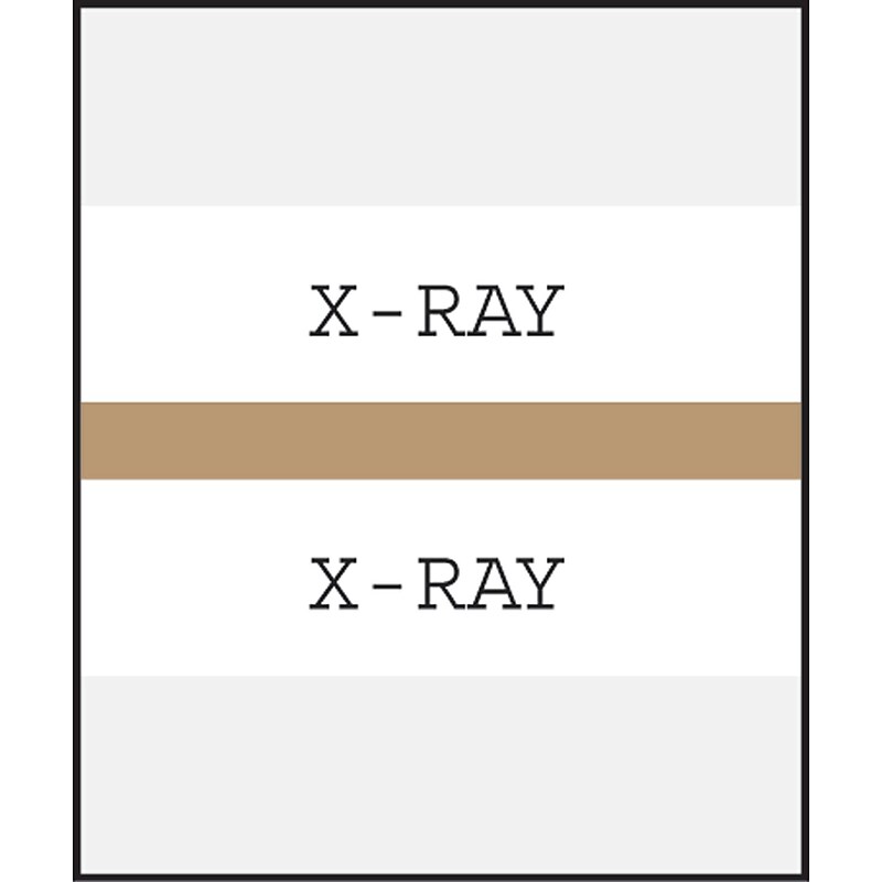 Medical Arts Press® Standard Preprinted Chart Divider Tabs; X-Ray, Tan image 1