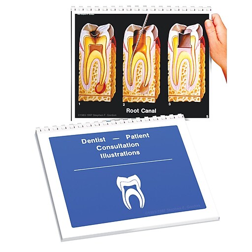 Spiral Bound Dental Consultation Flip Chart at Staples