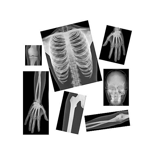 Roylco® True To Life Human XRays Staples
