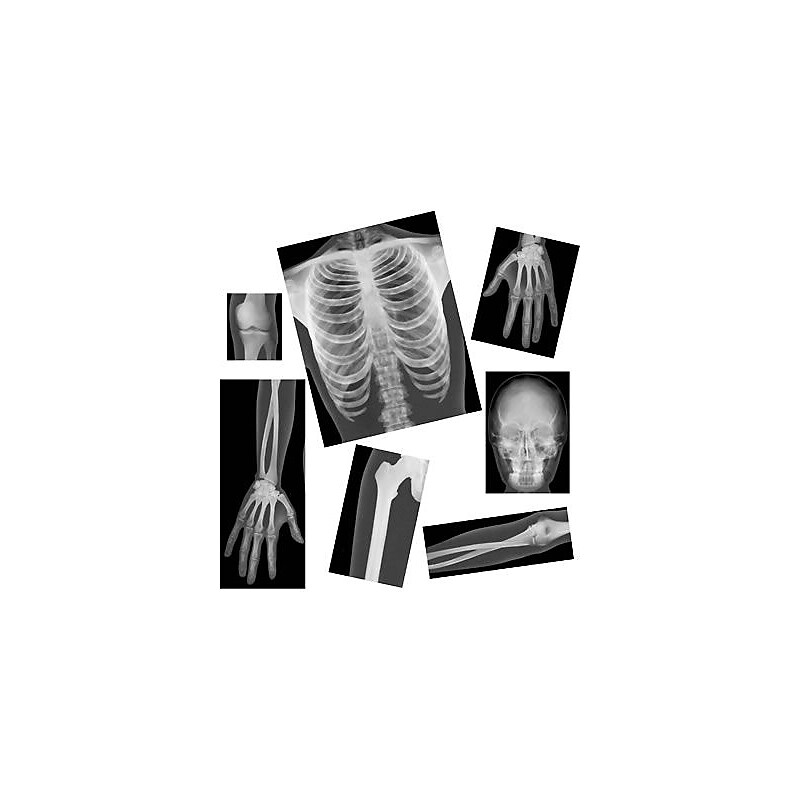 Roylco® True To Life Human X-Rays image 1