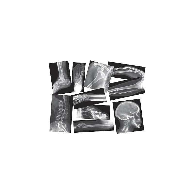 Roylco® Broken Bones X-Rays image 1